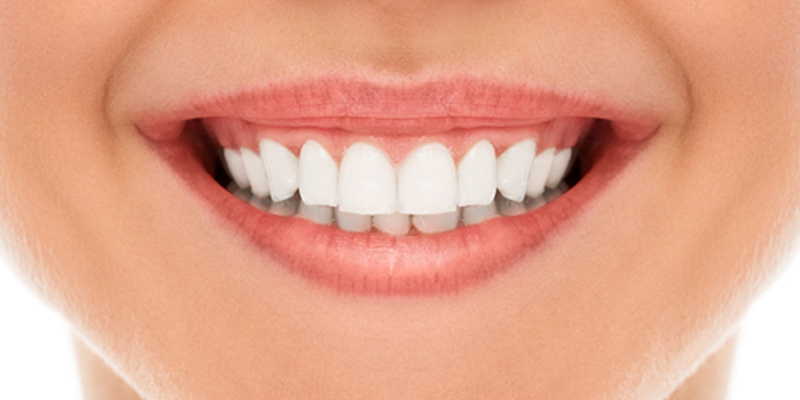 矯正治療で歯並びを整えませんか？