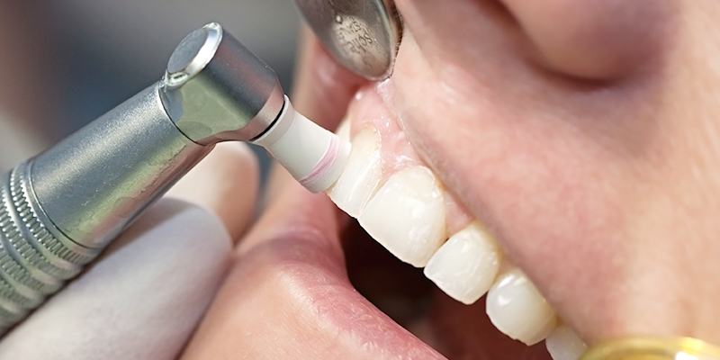 予防歯科はお口の健康をサポートします