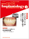2013年　Quintessence DENTAL Implantology　2013vol.20 NO.1