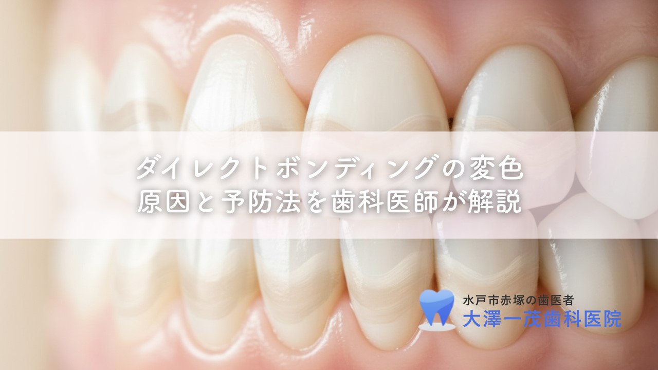 ダイレクトボンディングの変色〜原因と予防法を歯科医師が解説
