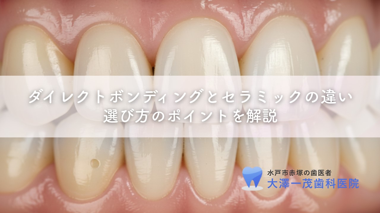 ダイレクトボンディングとセラミックの違い〜選び方のポイントを解説