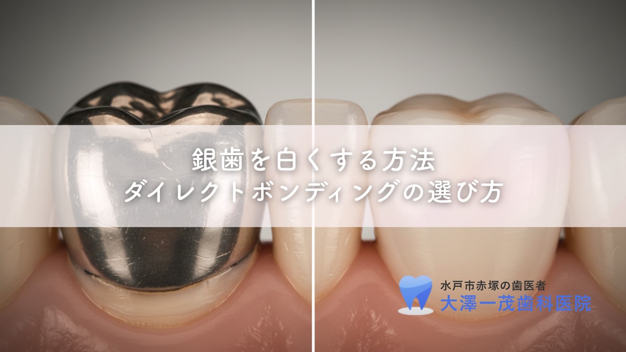 銀歯を白くする方法〜セラミックとダイレクトボンディングの選び方