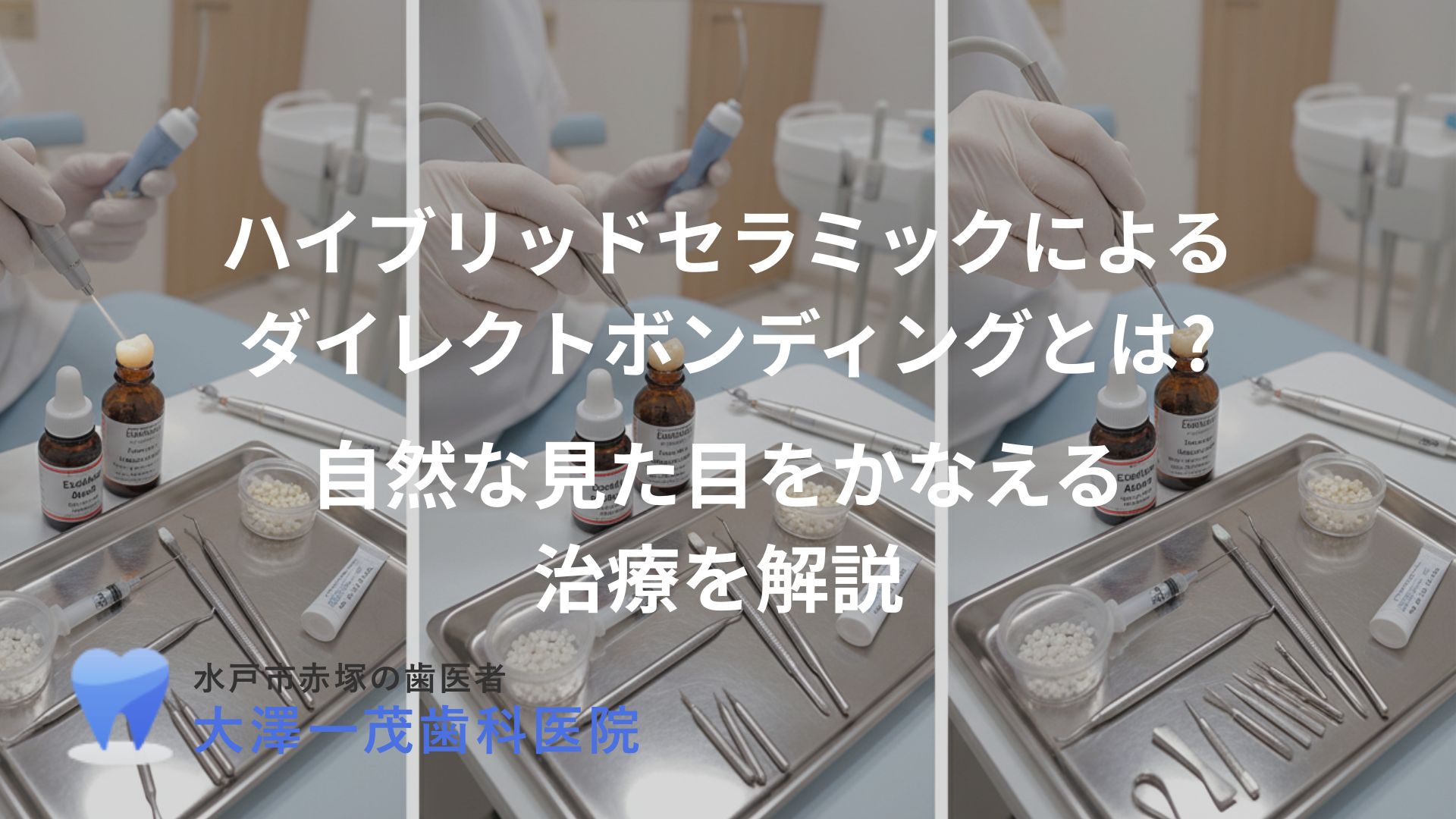 ハイブリッドセラミックによるダイレクトボンディングとは?〜自然な見た目をかなえる治療を解説