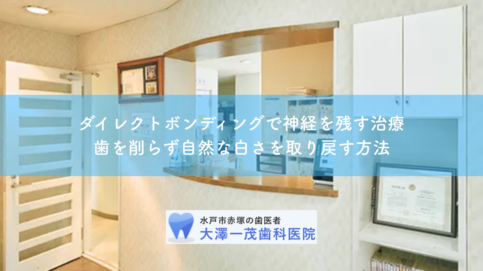ダイレクトボンディングで神経を残す治療｜歯を削らず自然な白さを取り戻す方法