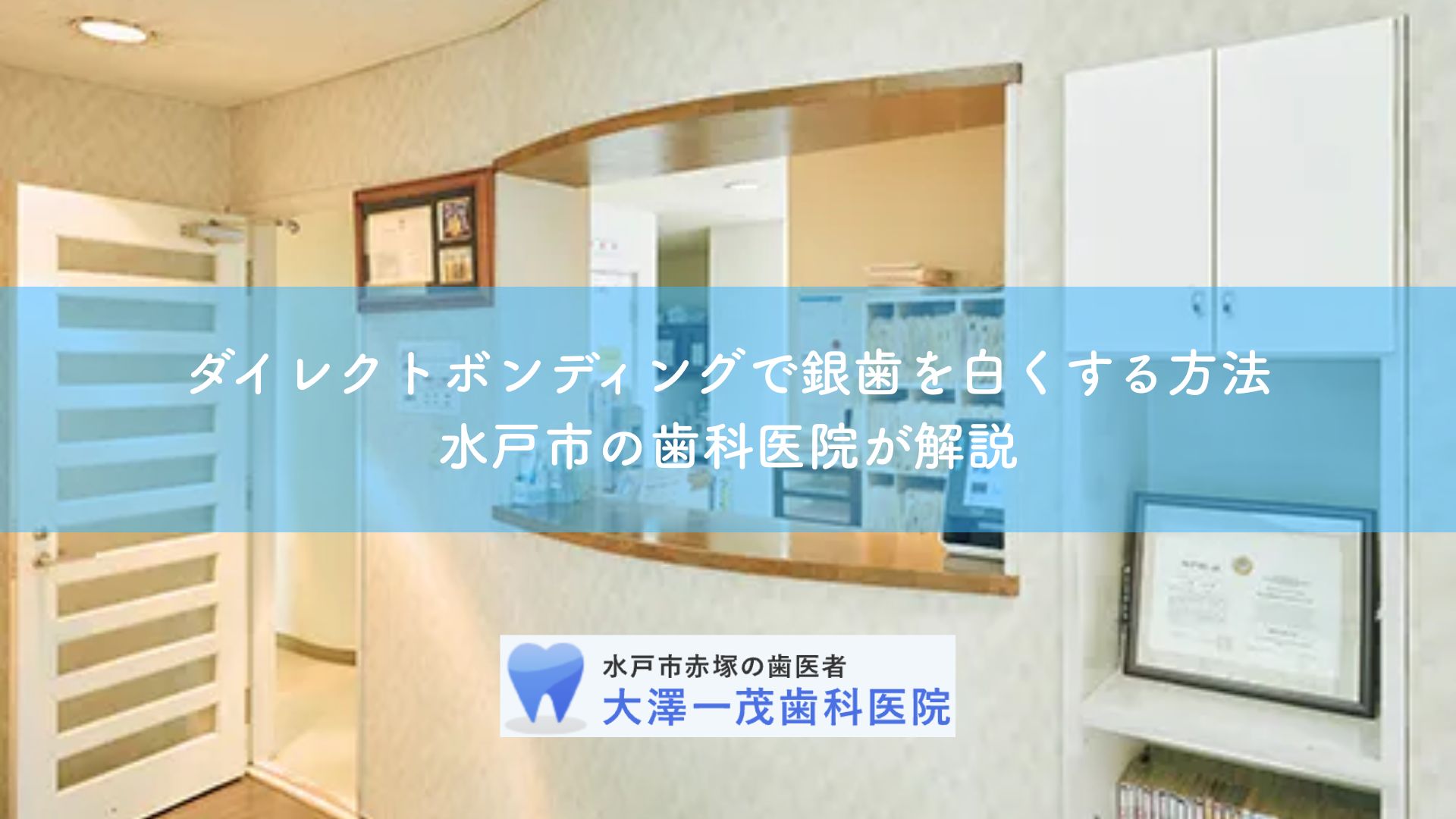 ダイレクトボンディングで銀歯を白くする方法｜水戸市の歯科医院が解説