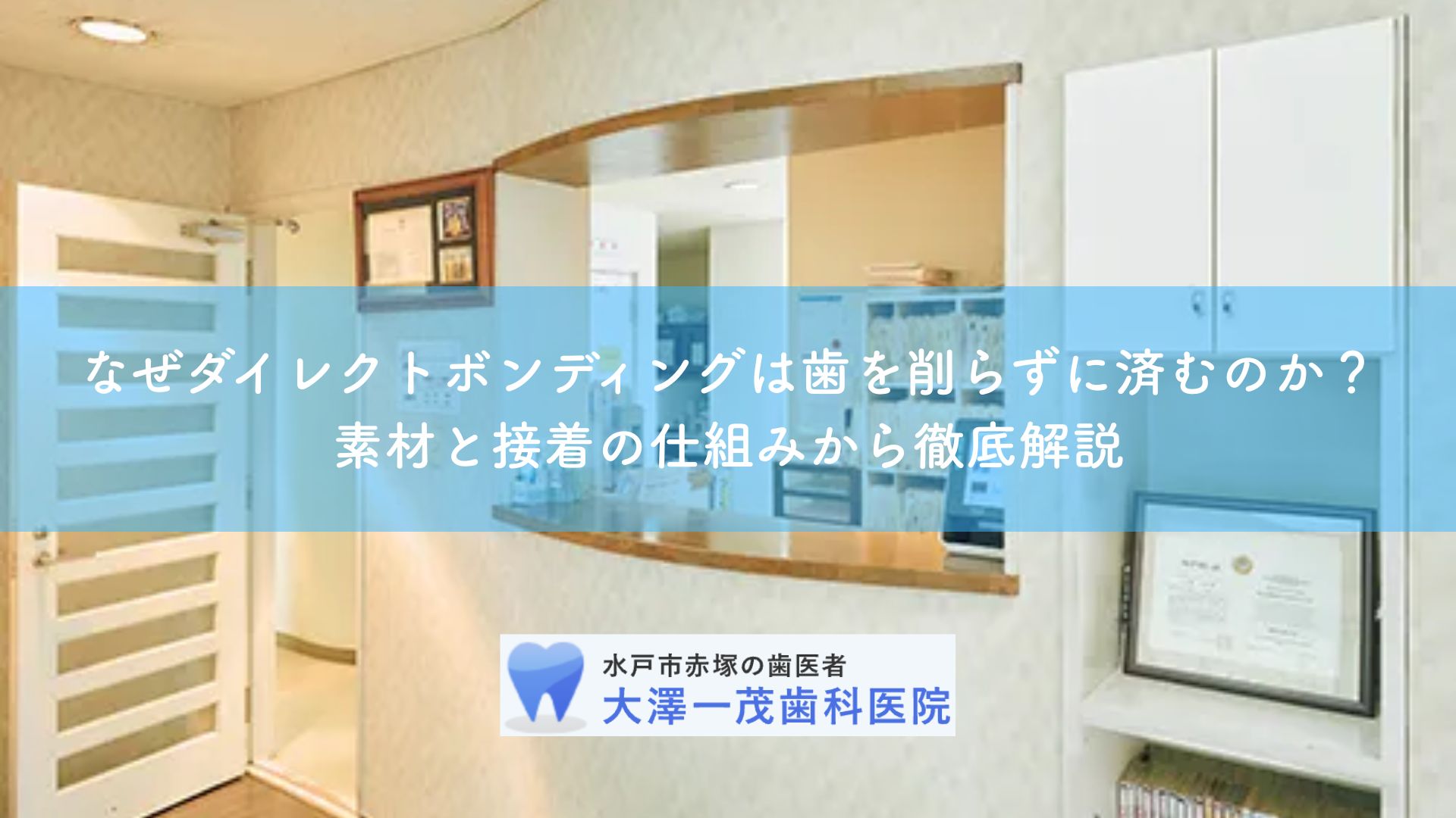 なぜダイレクトボンディングは歯を削らずに済むのか？素材と接着の仕組みから徹底解説